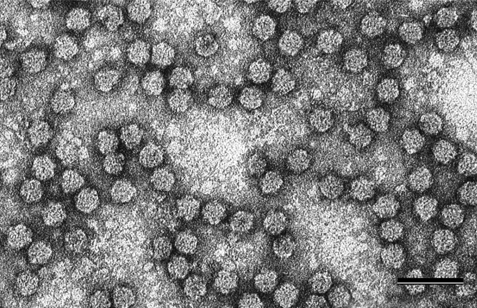 Представитель Семейства Nanoviridae